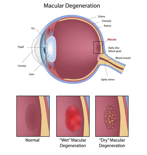 Poor Eyelid Closure (Lagophthalmos)