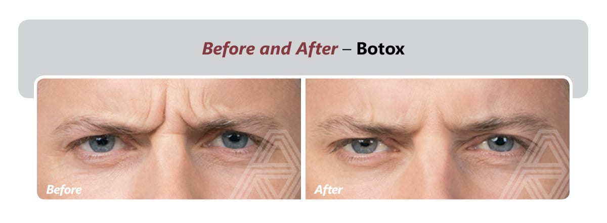 restylane-botox-dysport-juvederm-triad-eye-institute